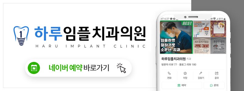 울산 임플란트 재수술 잘하는 치과